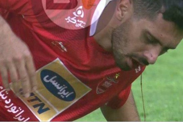  عکس/ لحظه‌ای که دهان عالیشاه پر از خون شد!